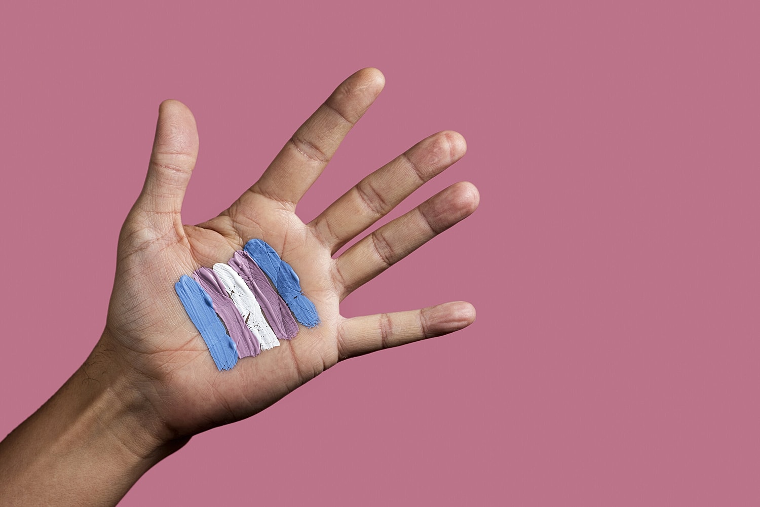 3 Things To Consider When Picking Your Top Surgeon