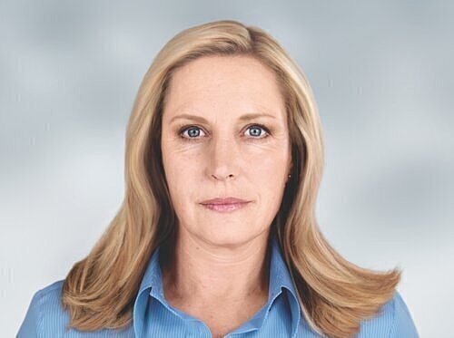sculptra patient after photo 1