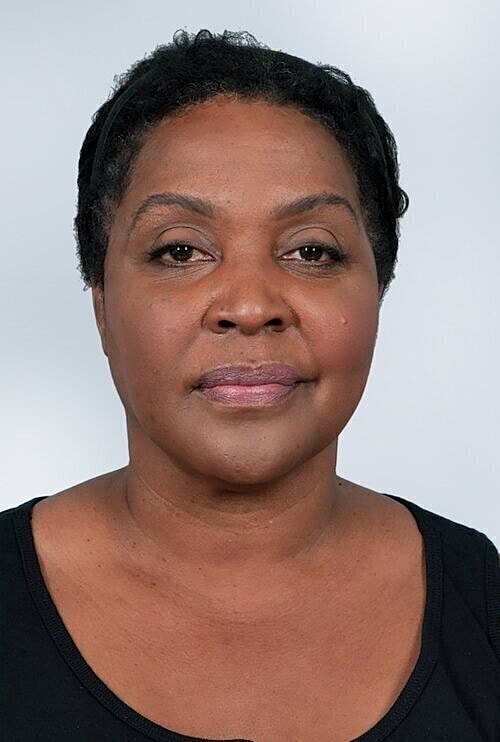 sculptra patient after photo 2