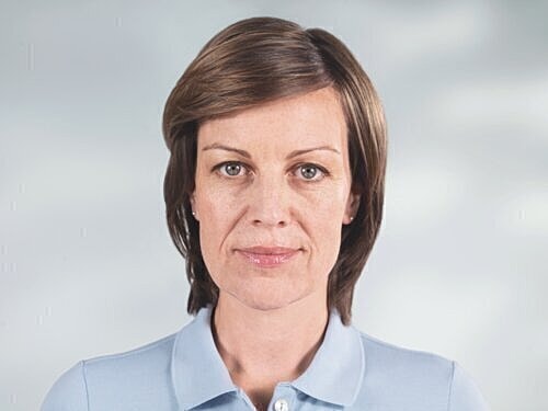 sculptra patient before photo 3