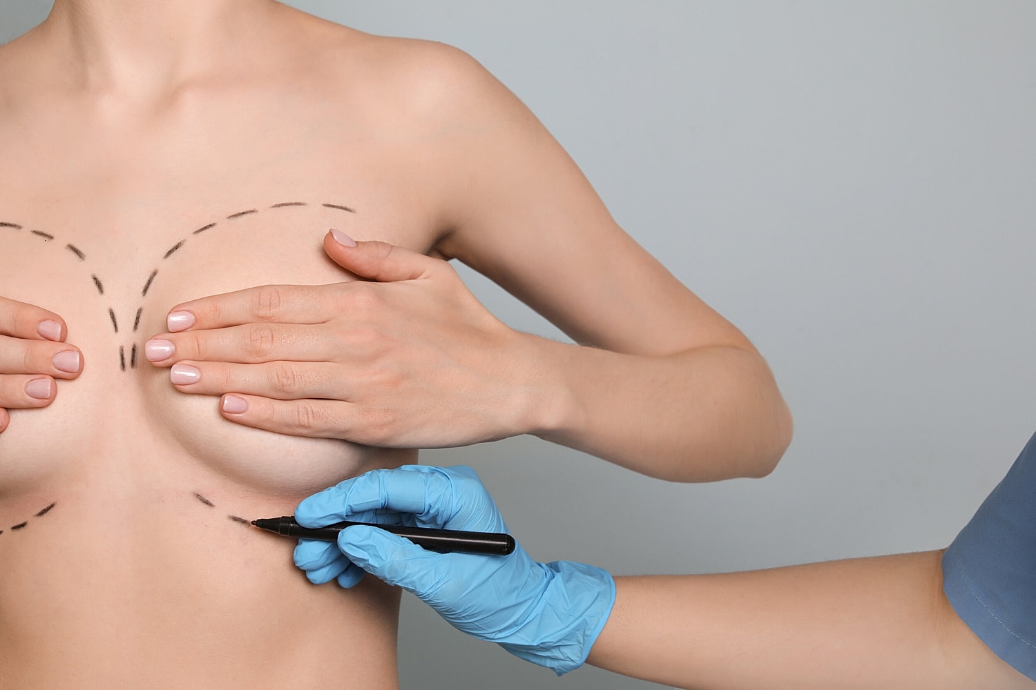 Boob Job FAQs: Answering Common Questions