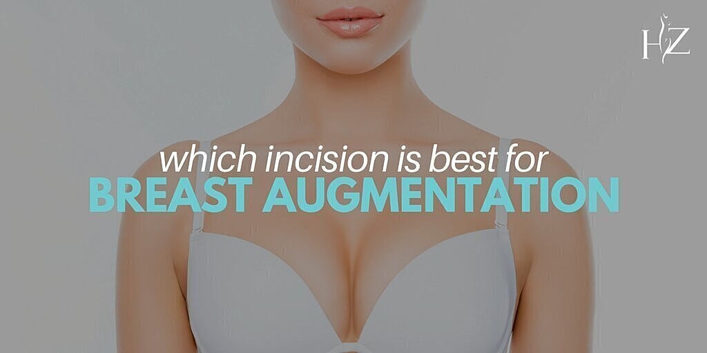 Which Incision Is Best For Breast Augmentation?