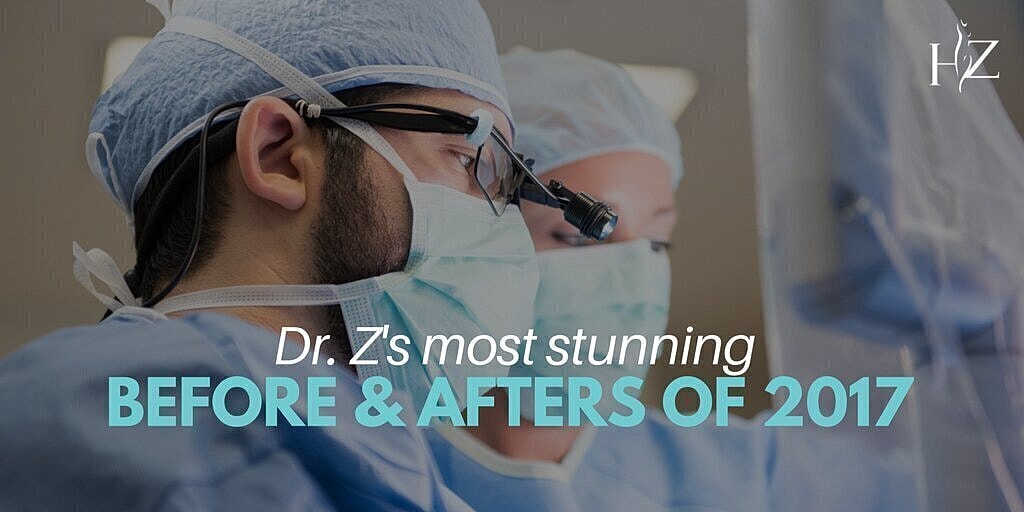 Dr. Z's Most Stunning Before & Afters of 2017
