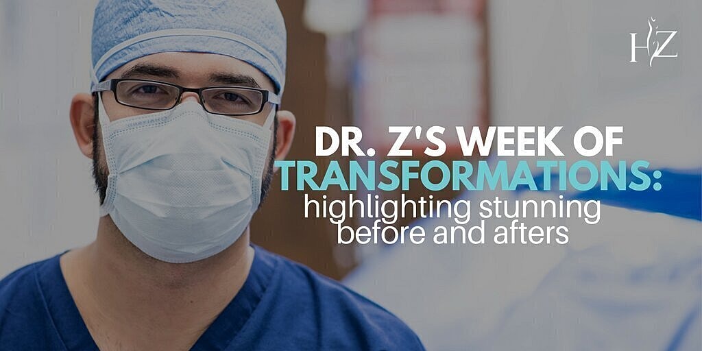 Dr. Z&apos;s Week of Transformations: Highlighting Stunning Before & Afters