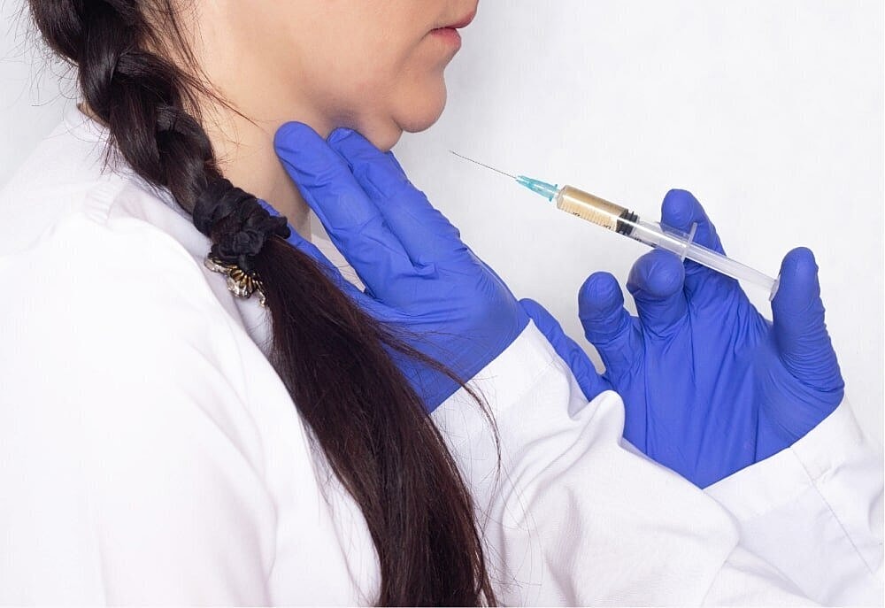 How To Get Rid Of Double Chin: Kybella To The Rescue