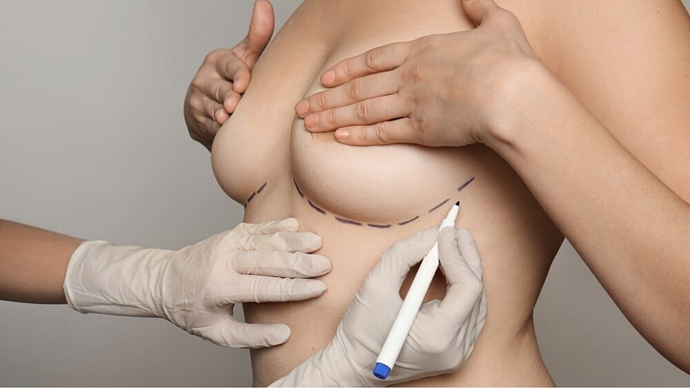 How To Take Care Of Your Post-Op Scars