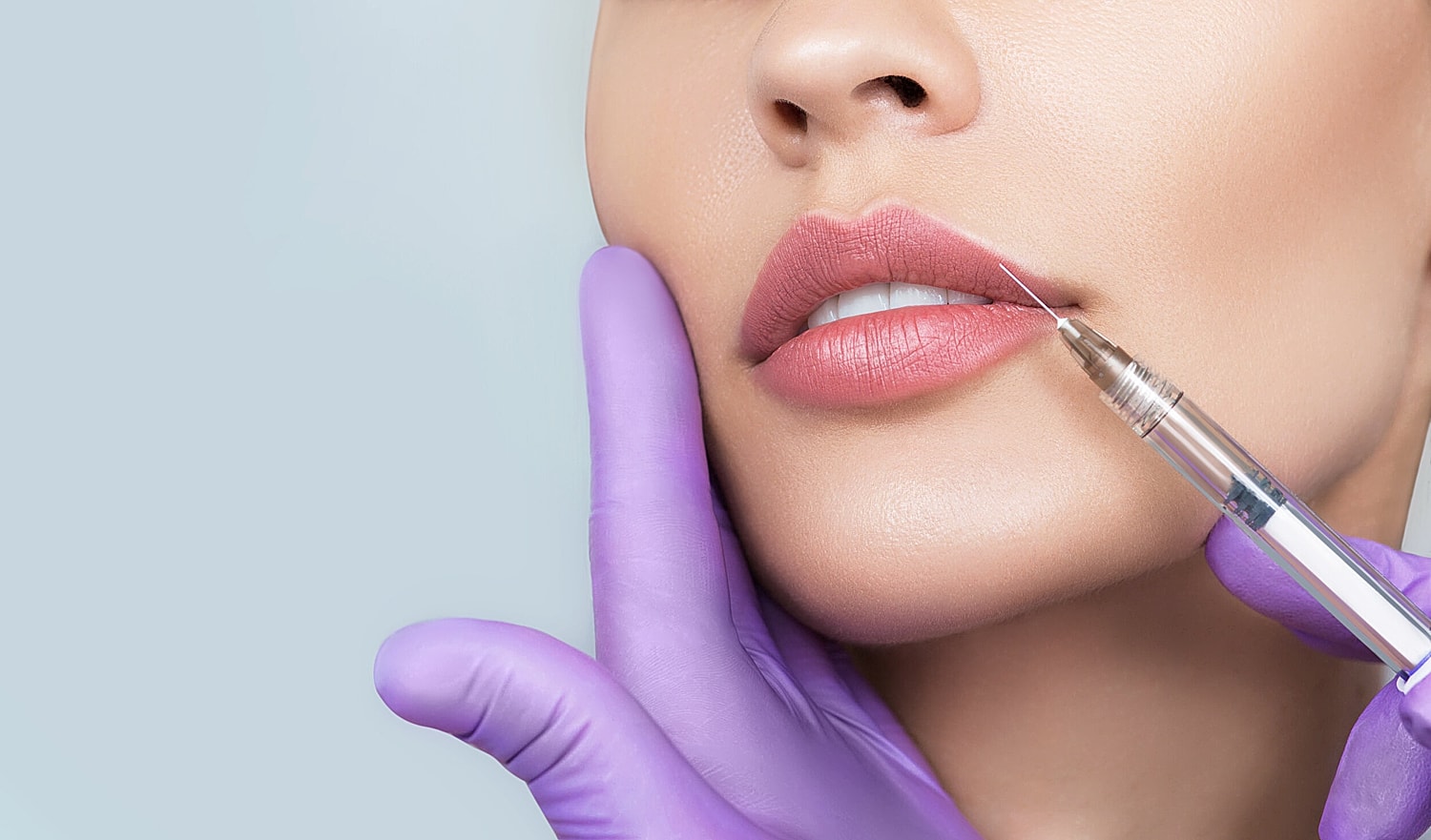 Lip Lift or Fillers? Why Surgery Might Be a Better Option