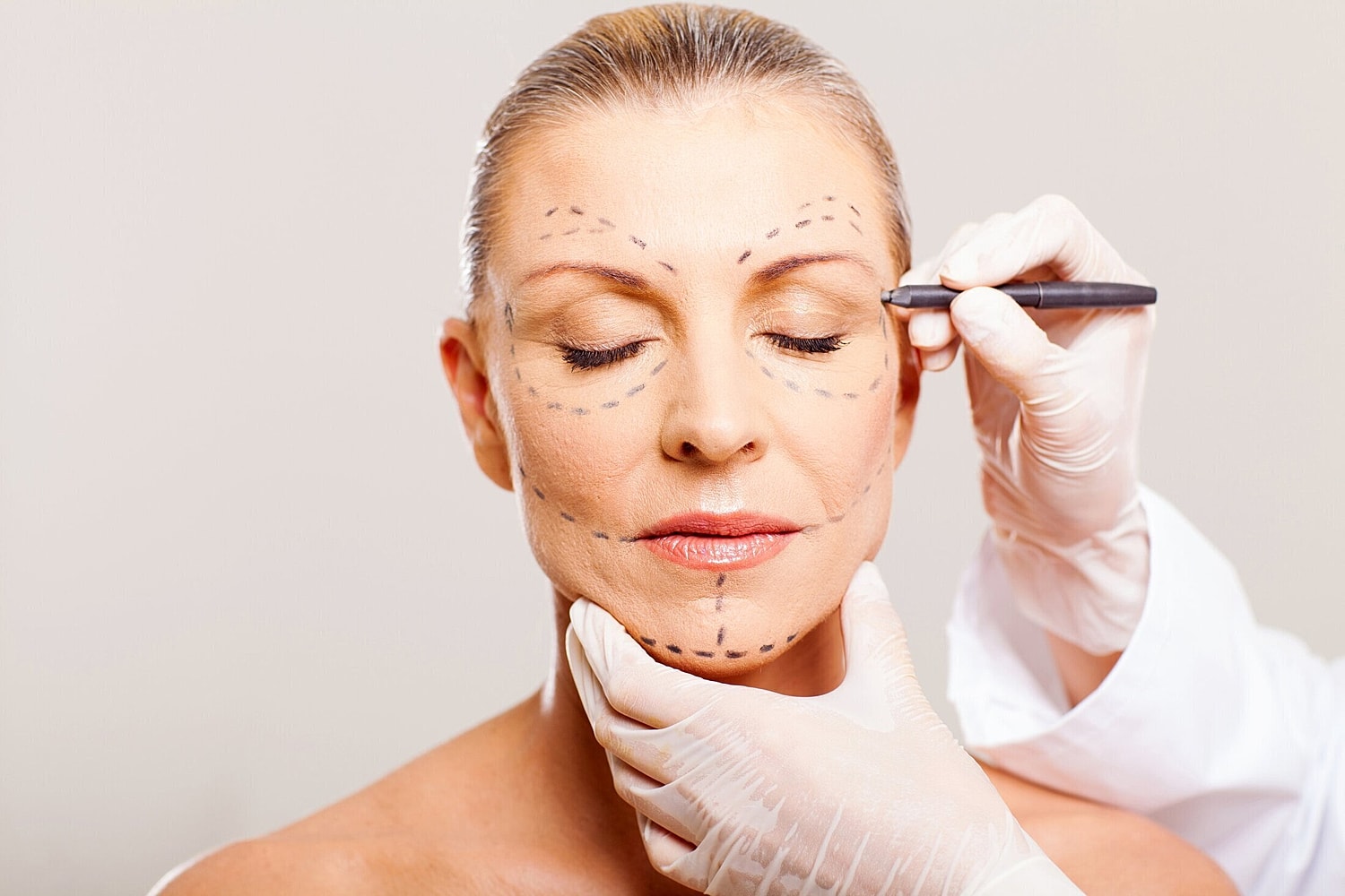 Should I Get A Facelift Or A Brow Lift?