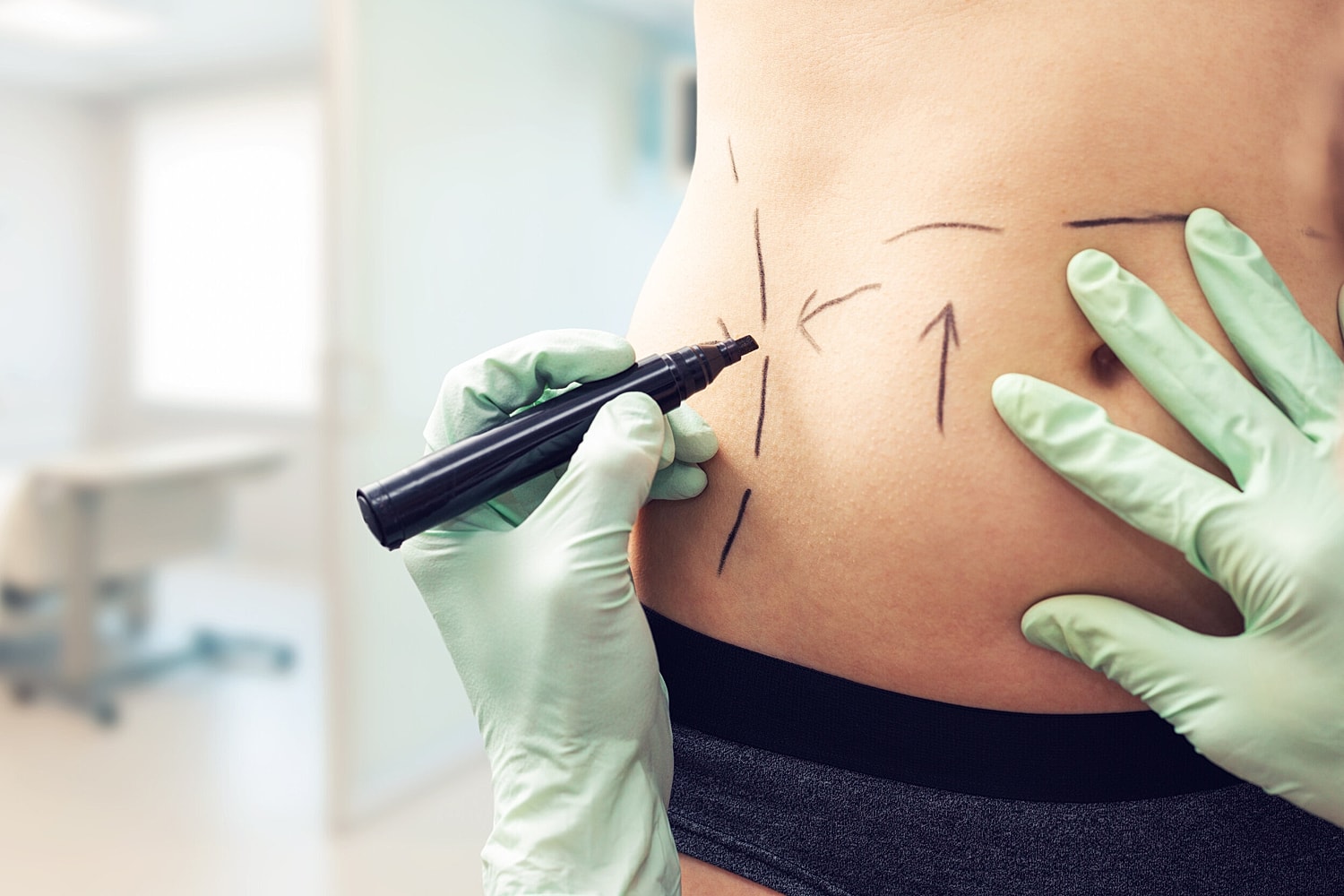 What&apos;s Included in a Mommy Makeover? Everything You Need to Know About This Life-Changing Procedure
