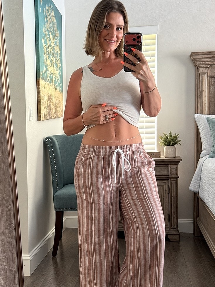 tummy tuck before and after in orlando