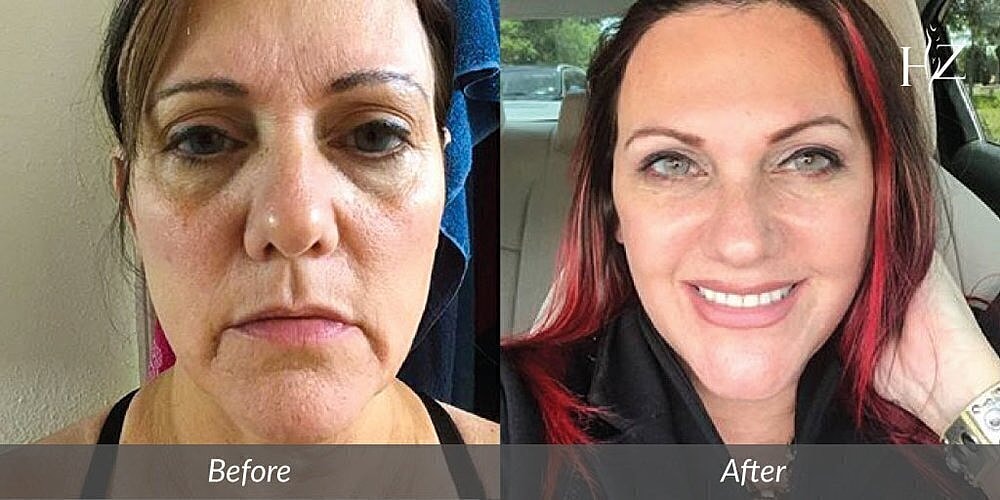 Before and after makeover transformation comparison
