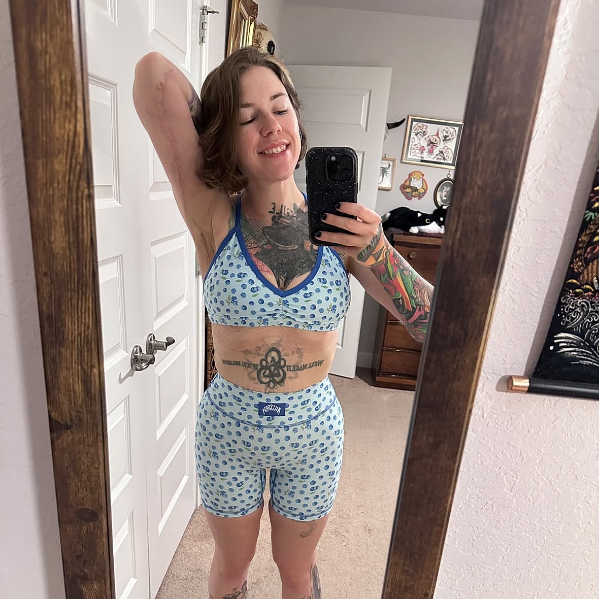 arm lift before and after orlando fl smiling in blue leopard print outfit.