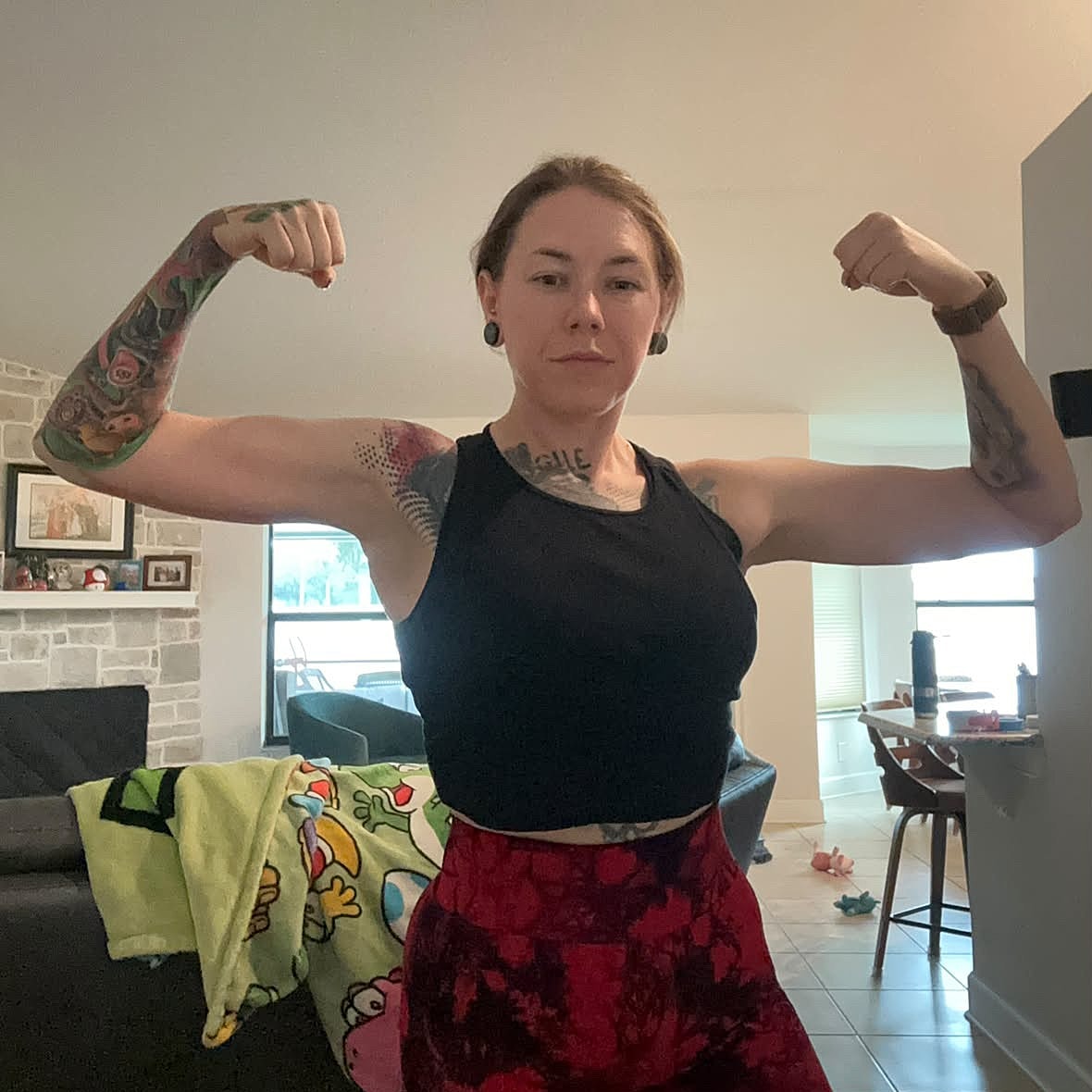 arm lift before and after orlando fl