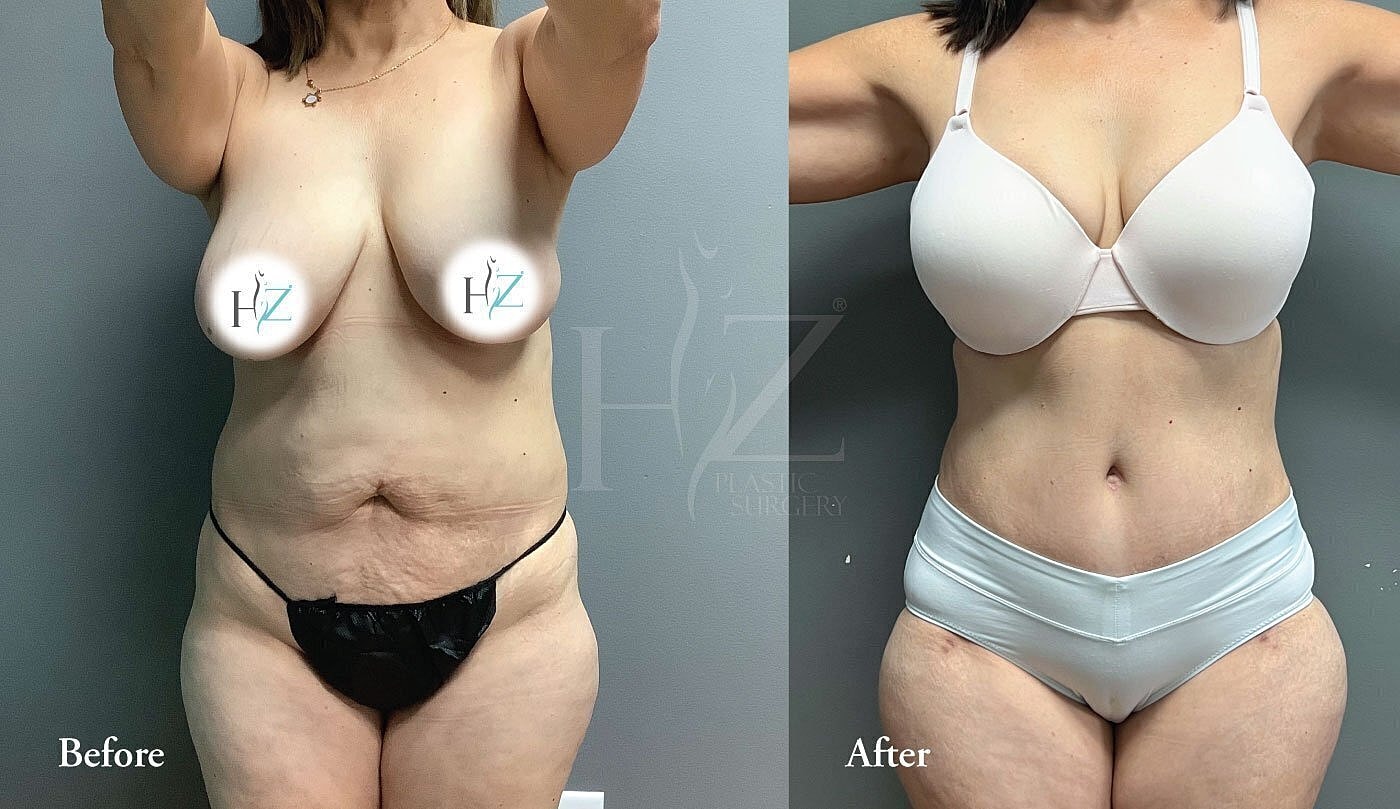 Before and after body transformation photos.
