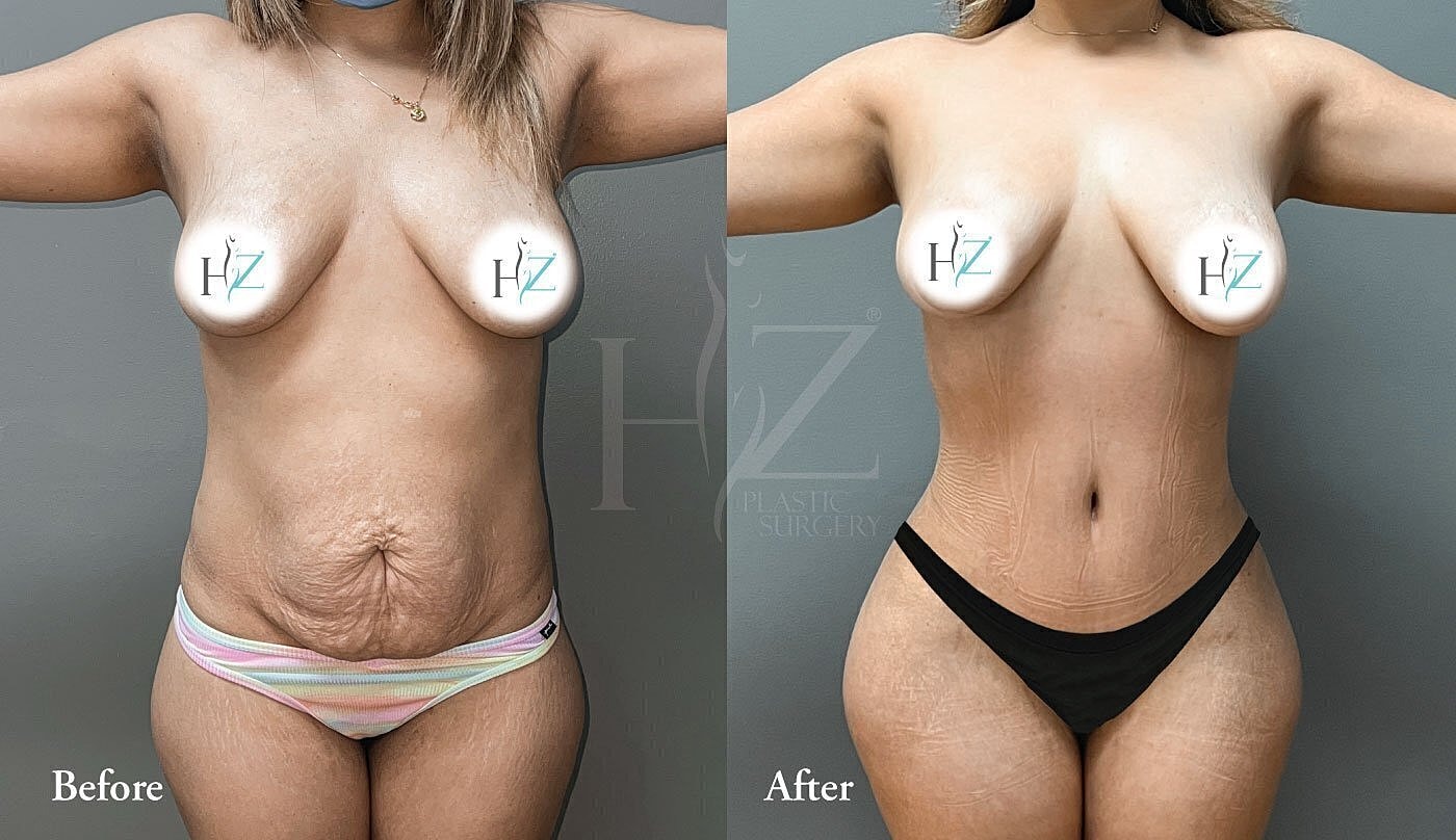 Before and after plastic surgery photos.