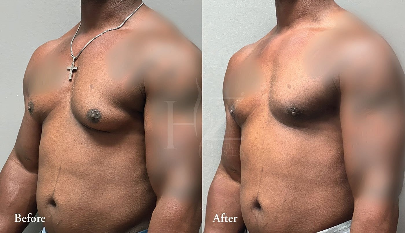 Before and after body transformation comparison image.