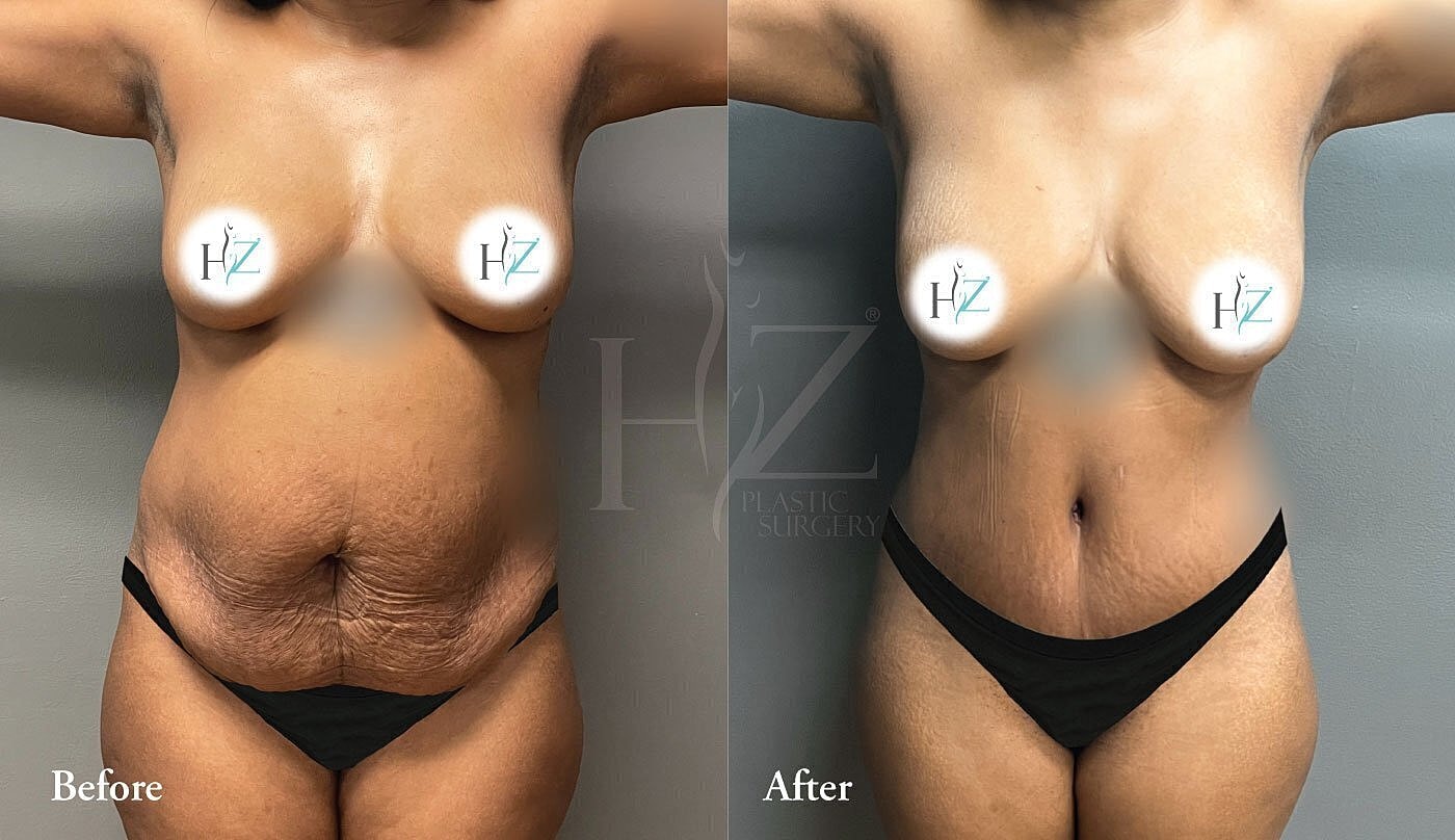 Before and after plastic surgery transformation.