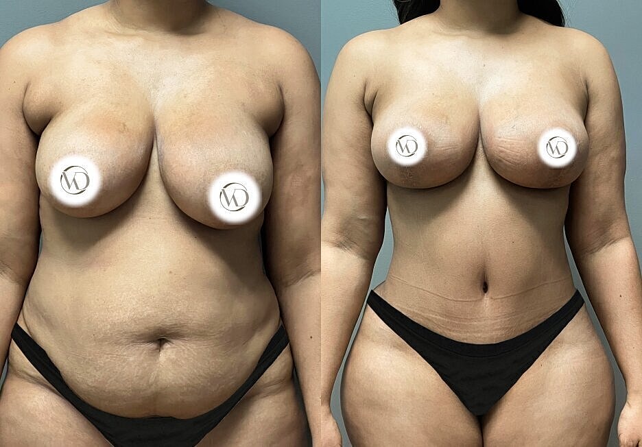 Before and after body transformation images.