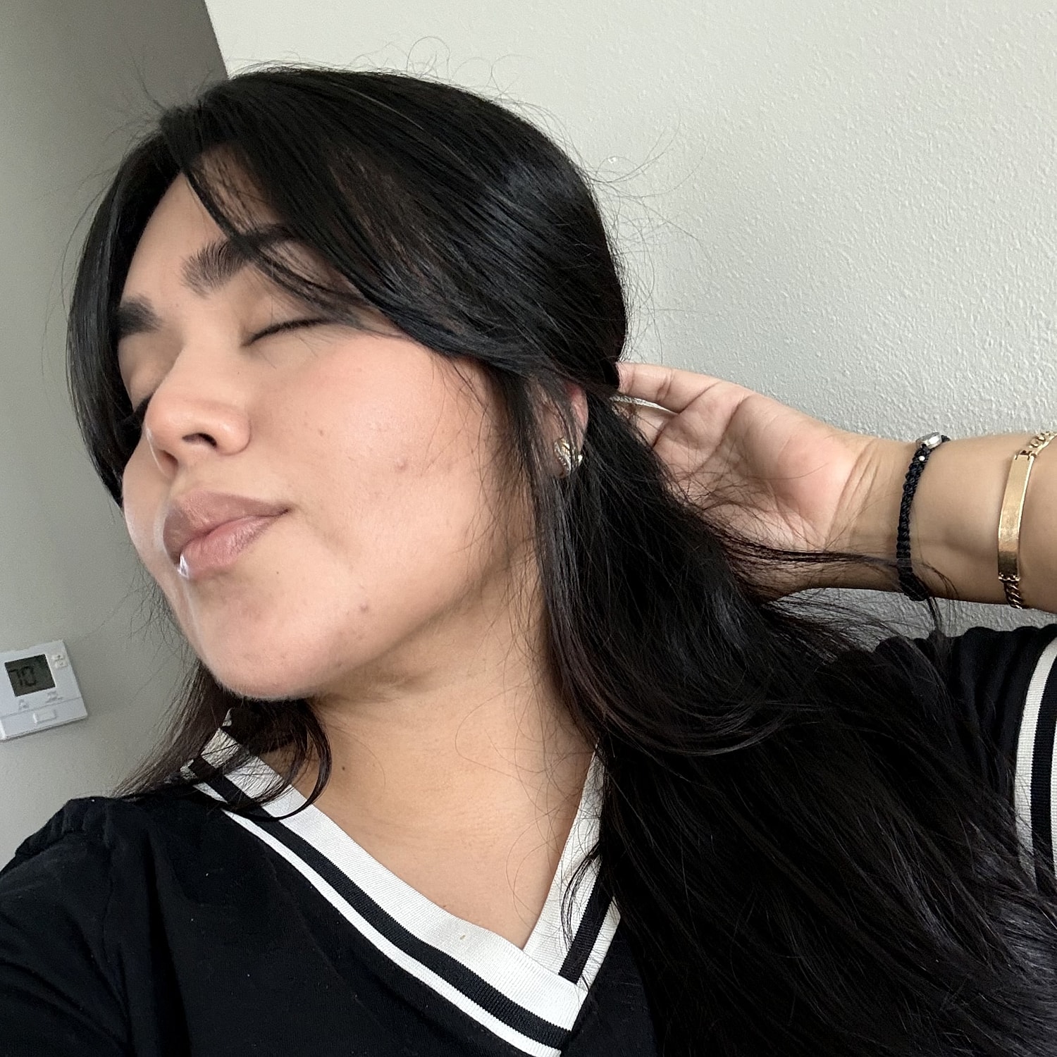 chin liposuction before and after
