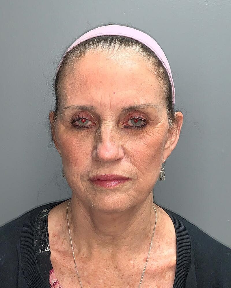 Facelift Before & After