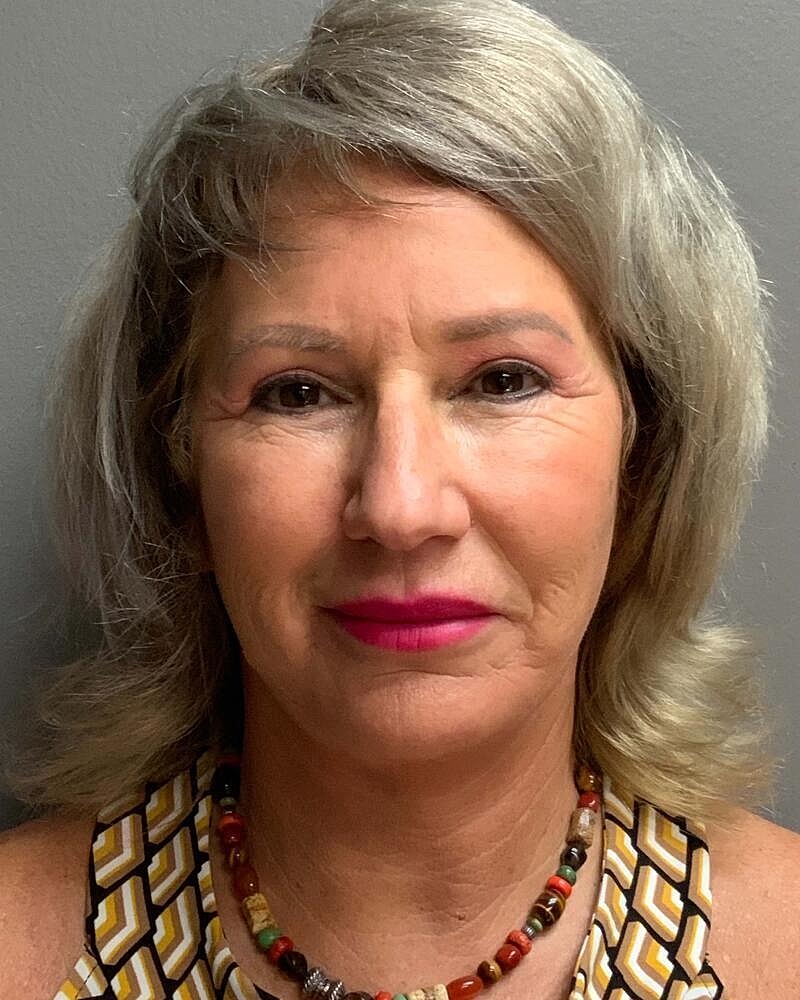 Facelift Before & After