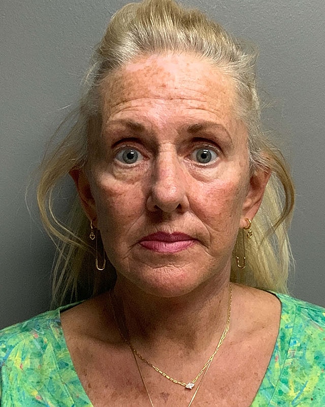 Facelift Before & After