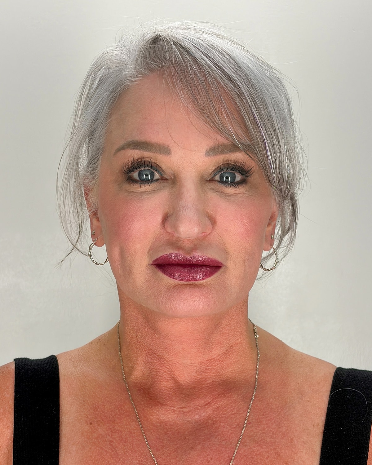 Facelift Gallery Before & After