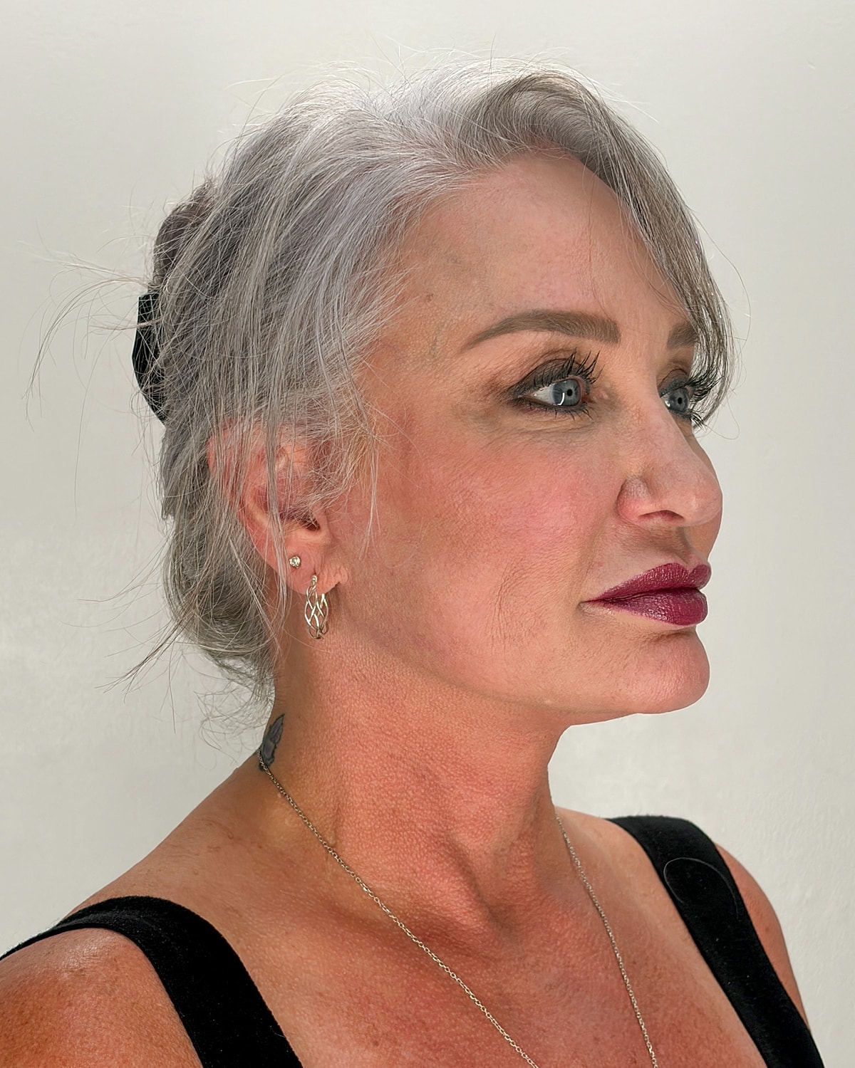 Facelift Gallery Before & After