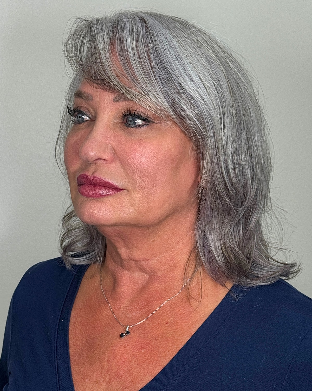 Facelift Gallery Before & After