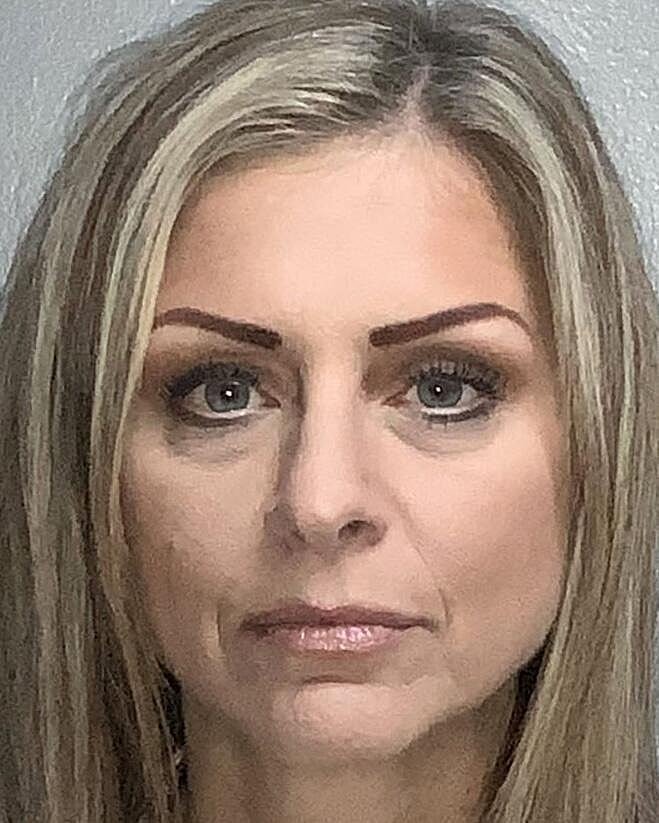 Blepharoplasty Before & After