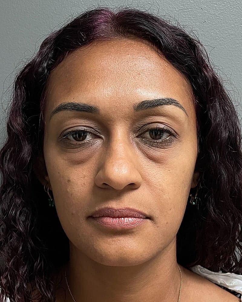 Blepharoplasty Before & After