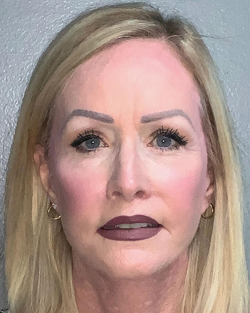 Blepharoplasty Before & After