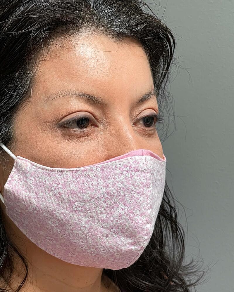 Blepharoplasty Before & After