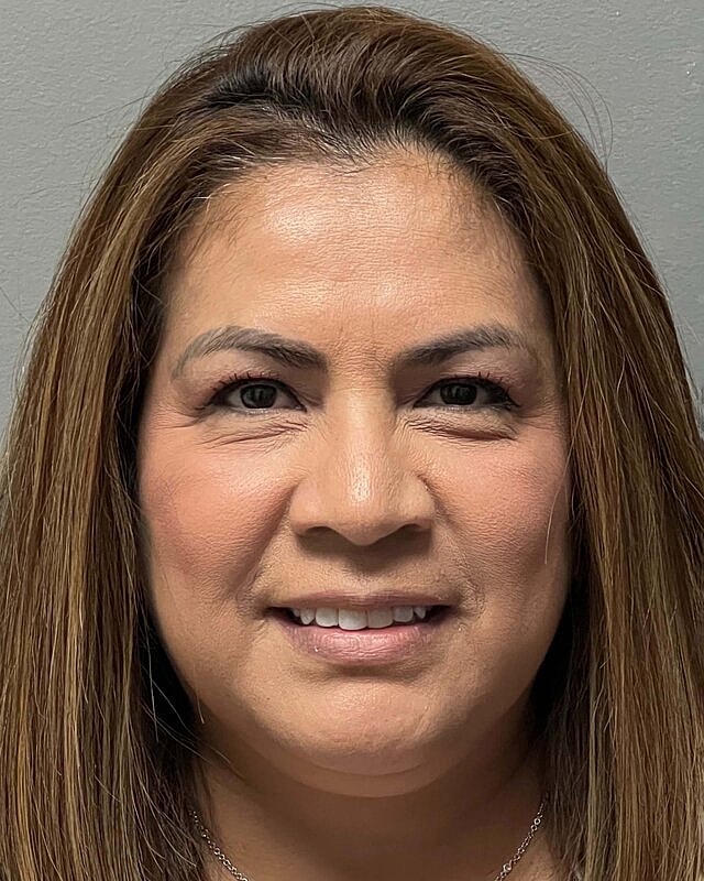 Blepharoplasty Before & After