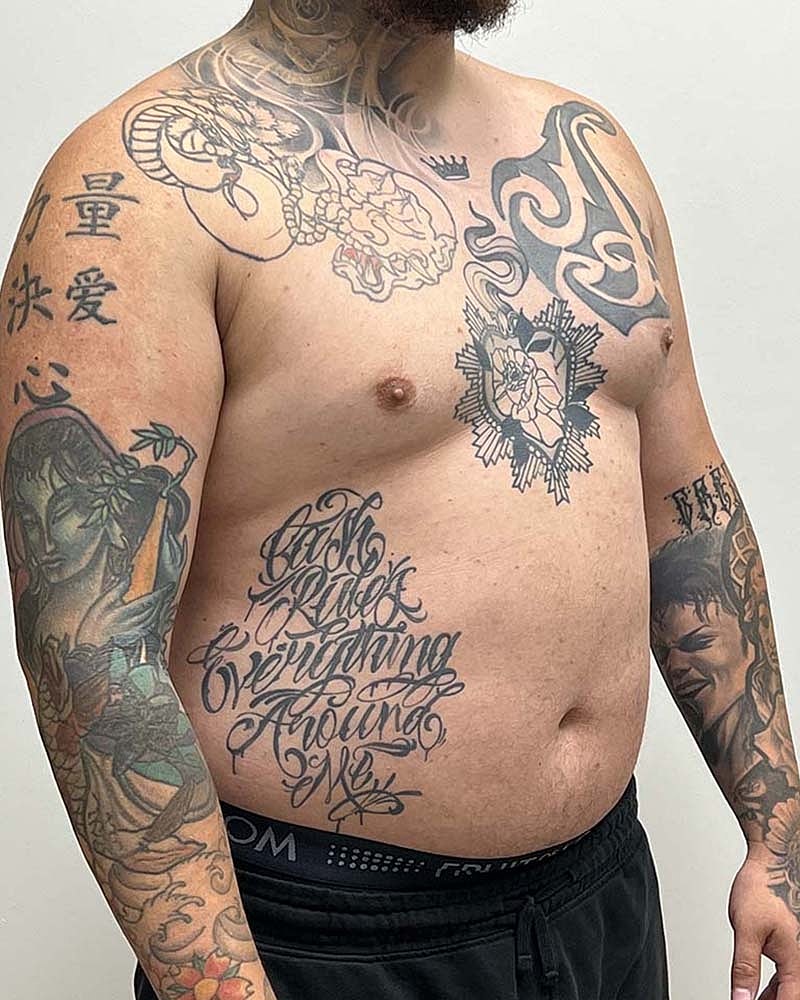 Gynecomastectomy Before & After