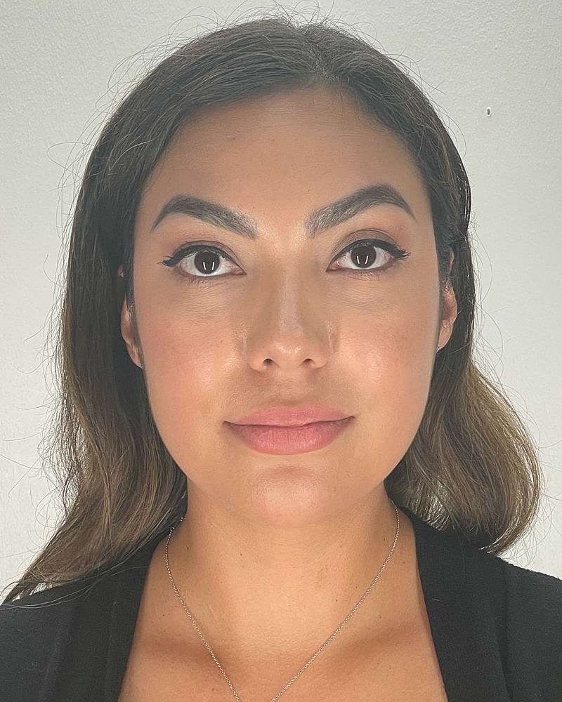 Chin Liposuction Before & After