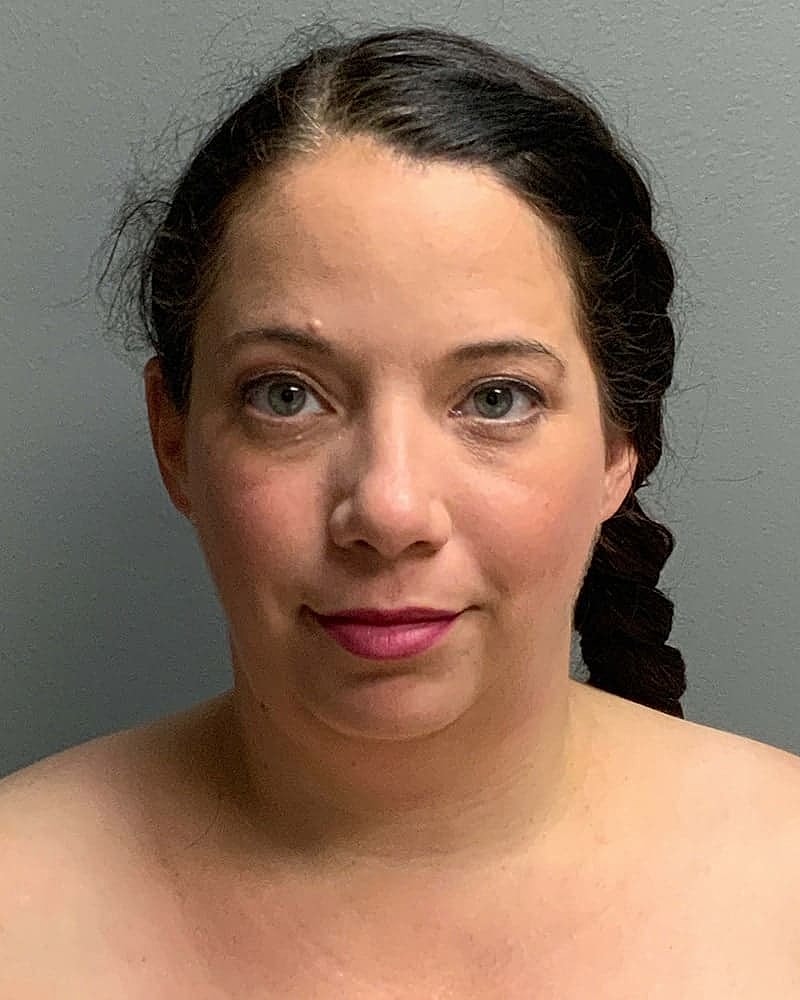 Chin Liposuction Before & After
