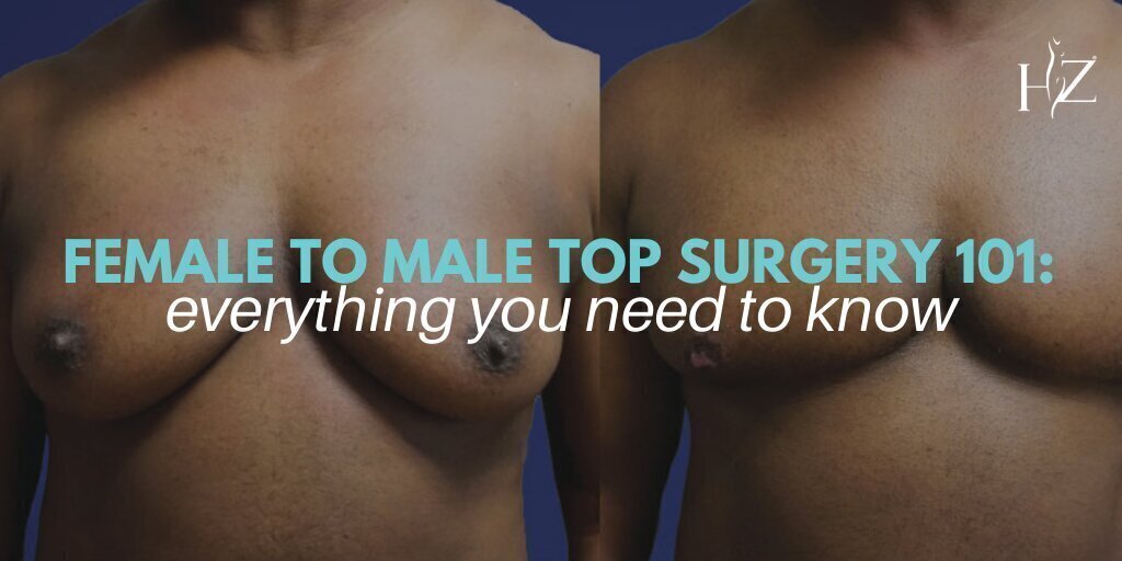 ftm top surgery patient model
