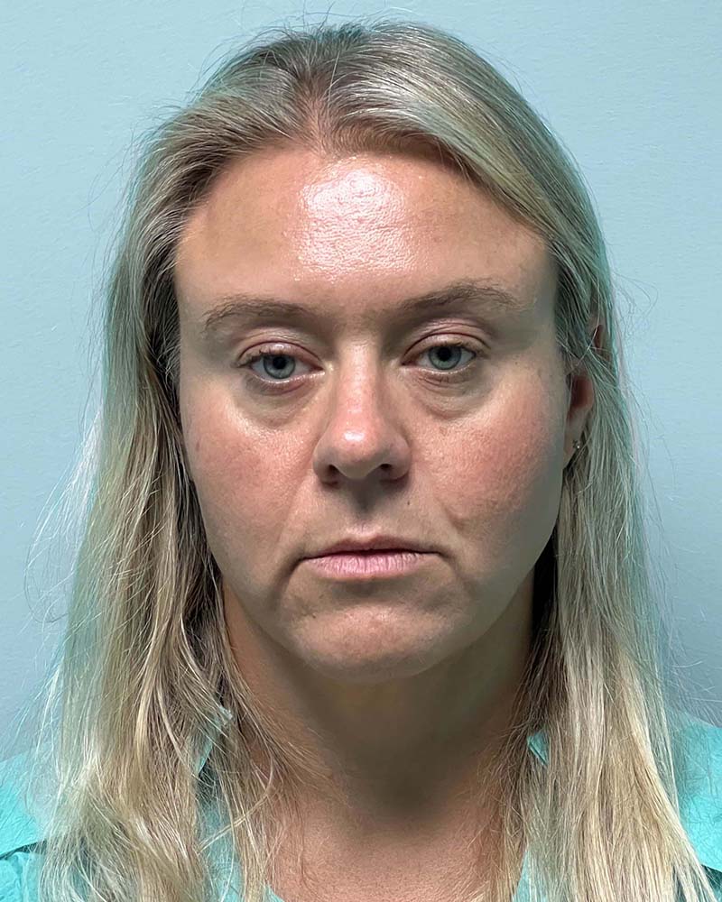 Renuvion Before & After Image