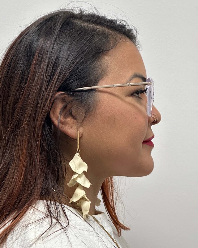 Renuvion Before & After Image