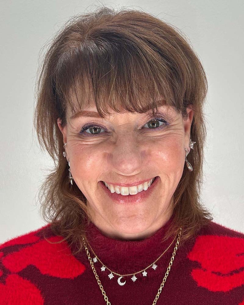 Blepharoplasty Before & After Image