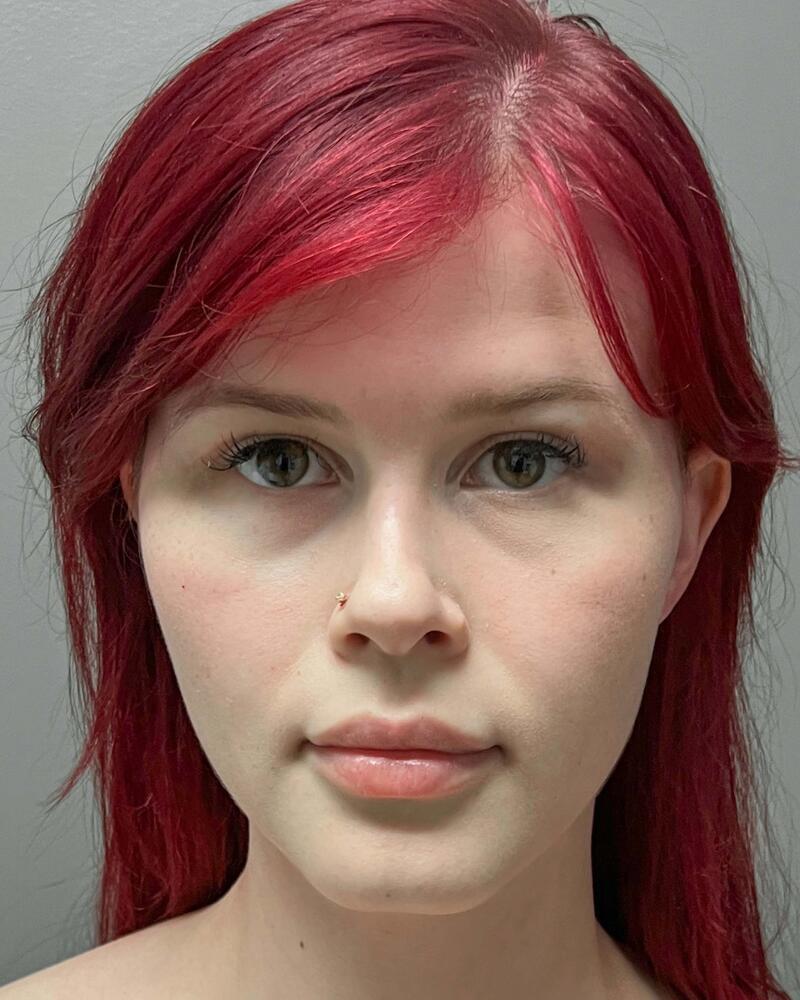 Blepharoplasty Before & After Image