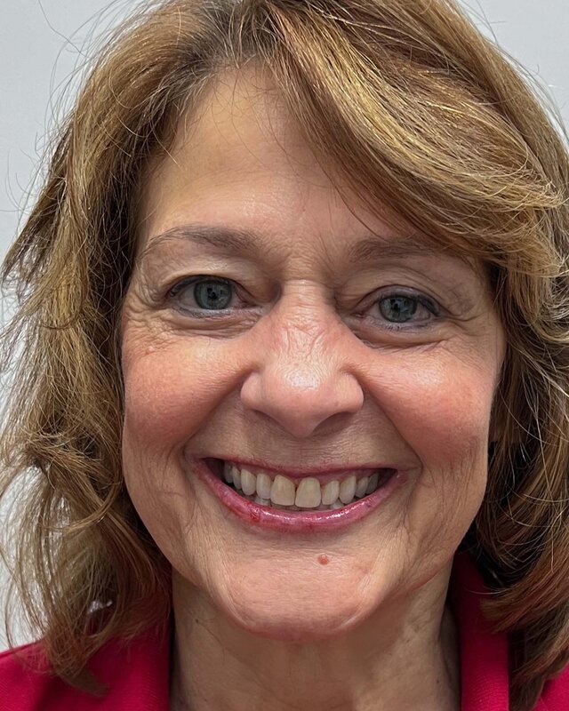 Blepharoplasty Before & After Image