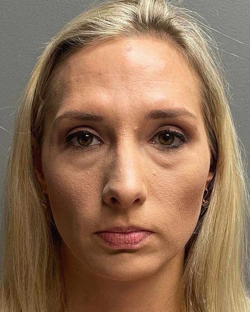 Blepharoplasty Before & After Image