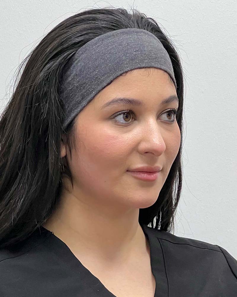 Chin Liposuction Before & After Image