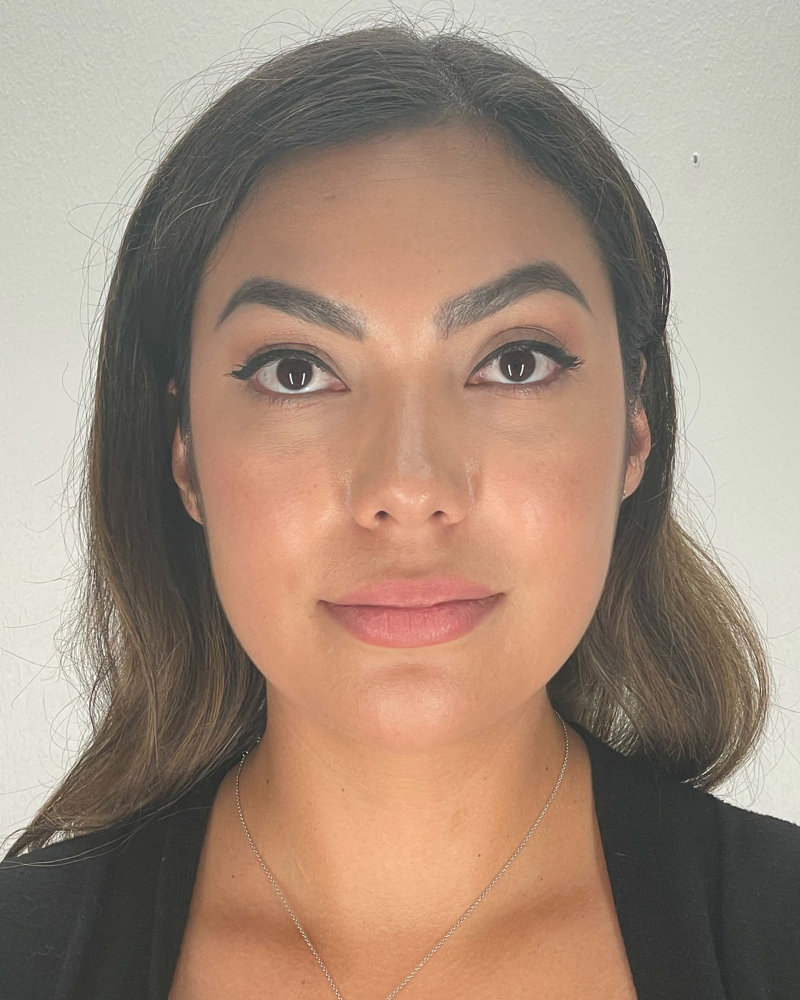 Chin Liposuction Before & After Image