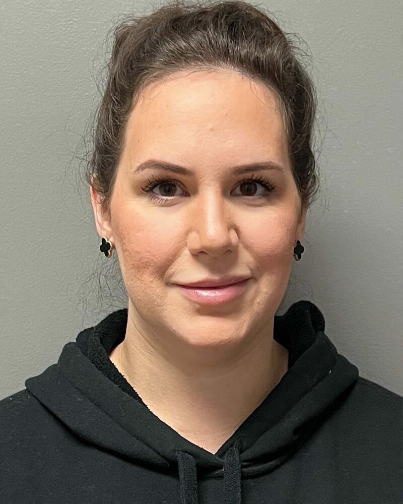 Chin Liposuction Before & After Image