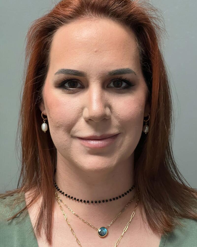 Chin Liposuction Before & After Image