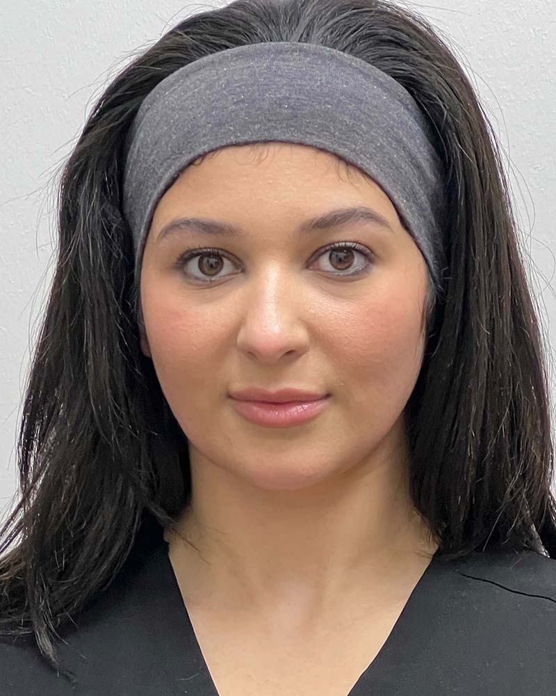 Chin Liposuction Before & After Image