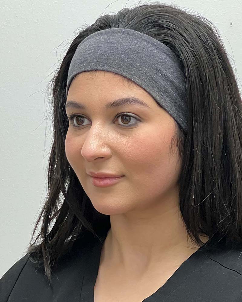 Chin Liposuction Before & After Image